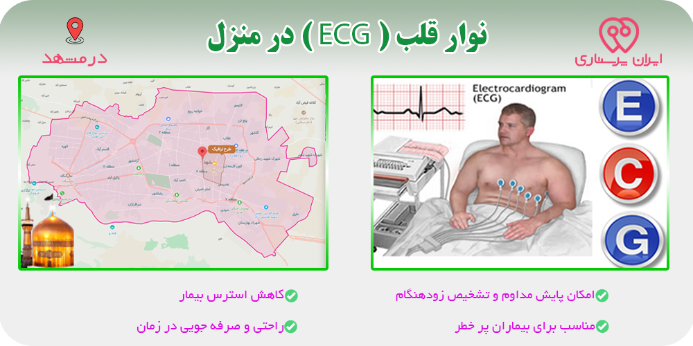 نوار قلب (ECG) در منزل مشهد
