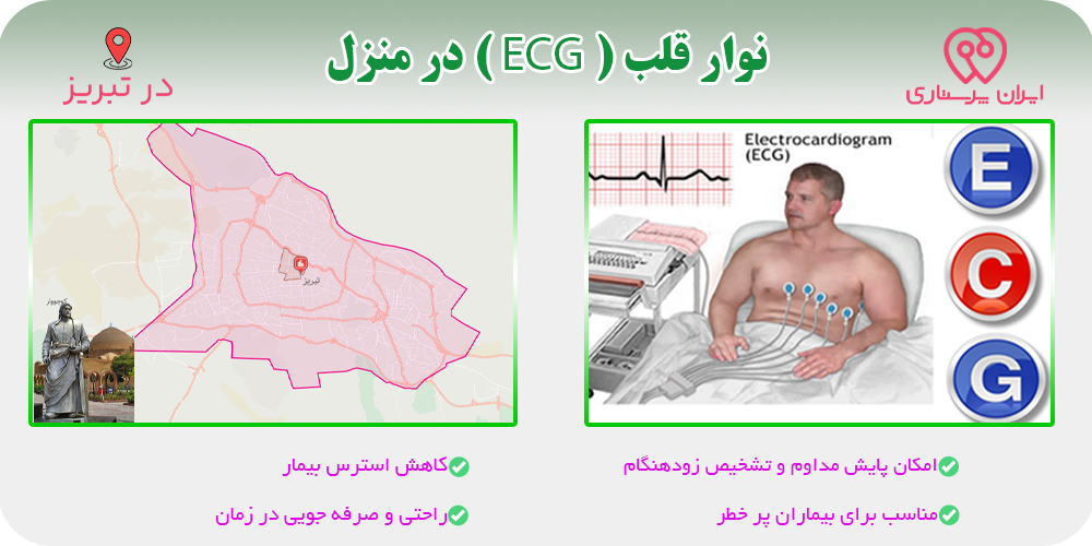 نوار قلب (ECG) در منزل تبریز
