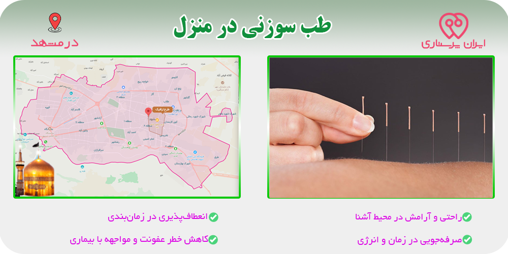 طب سوزنی در منزل مشهد