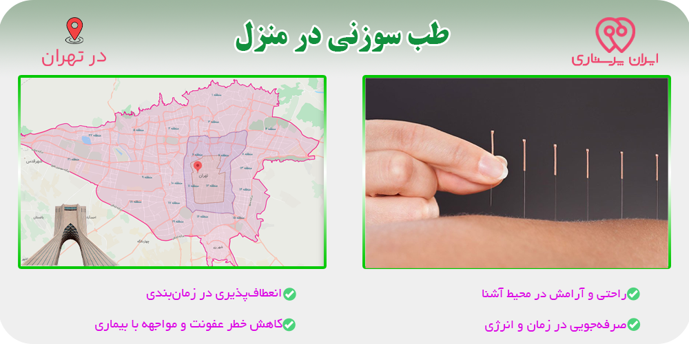 طب سوزنی در منزل تهران