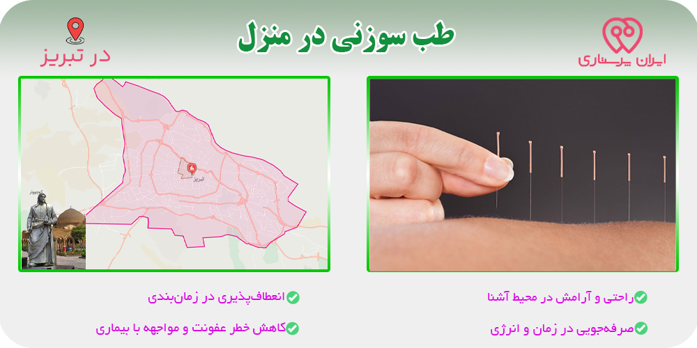 طب سوزنی در منزل تبریز