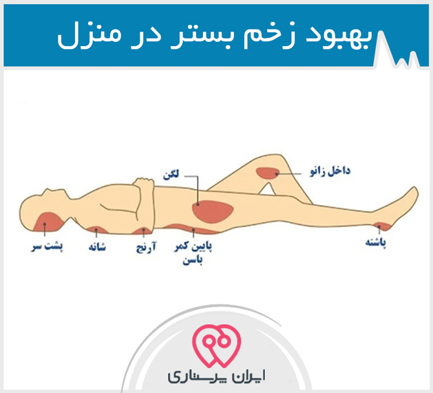 درمان زخم بستر در منزل  تهران