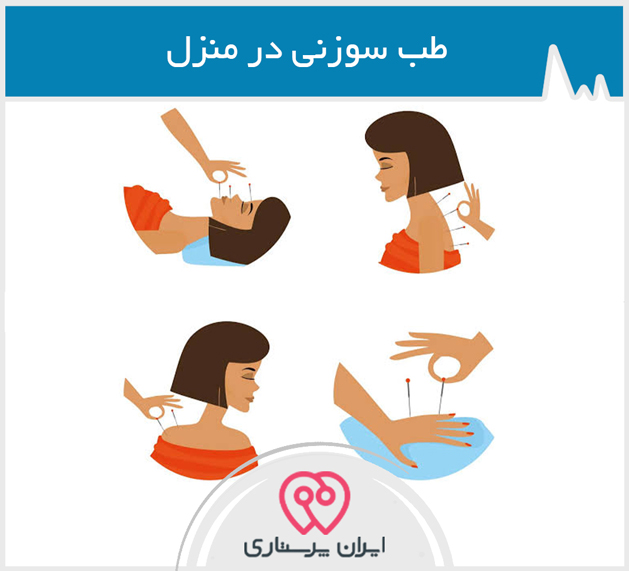 طب سوزنی در منزل تهران