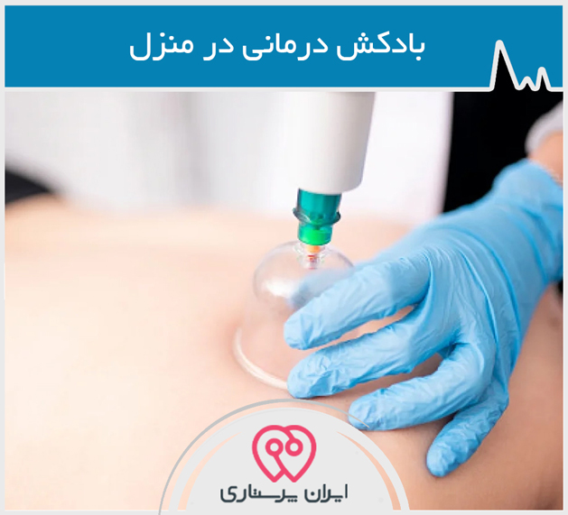 بادكش درمانی در منزل در تهران